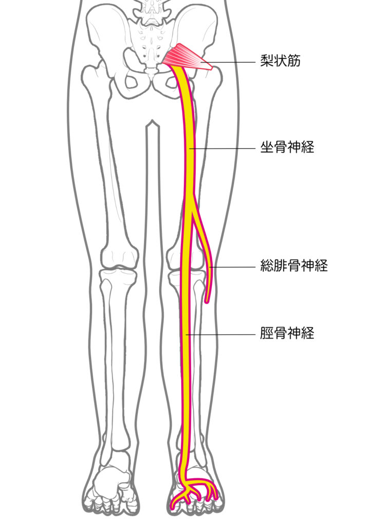 坐骨神経痛の病態