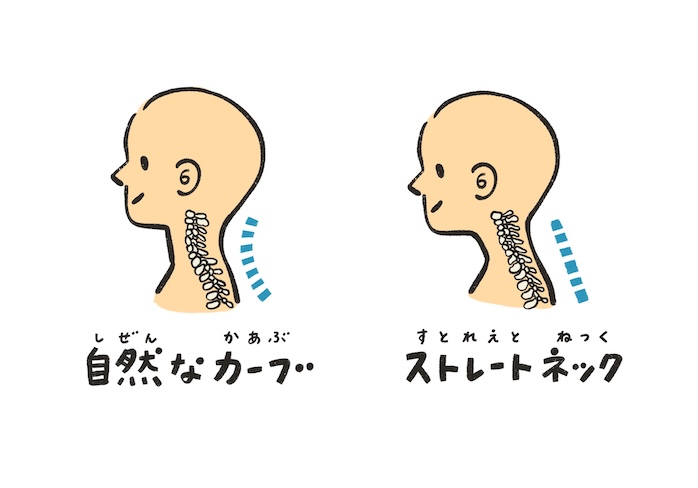 ストレートネック